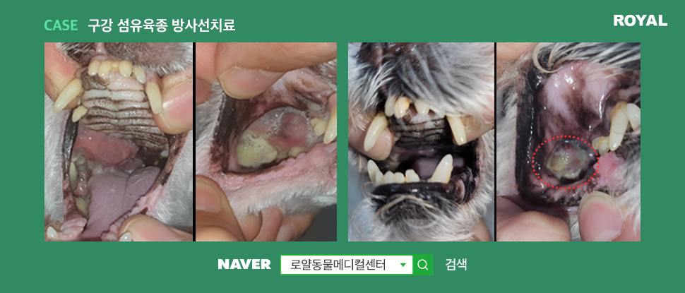 구강 섬유육종